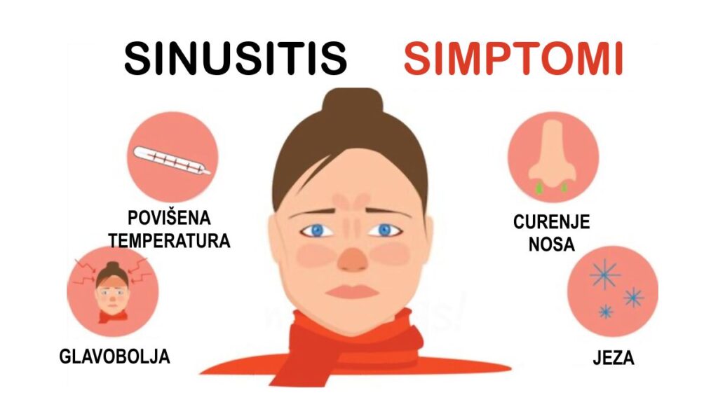 Upala sinusa - simptomi